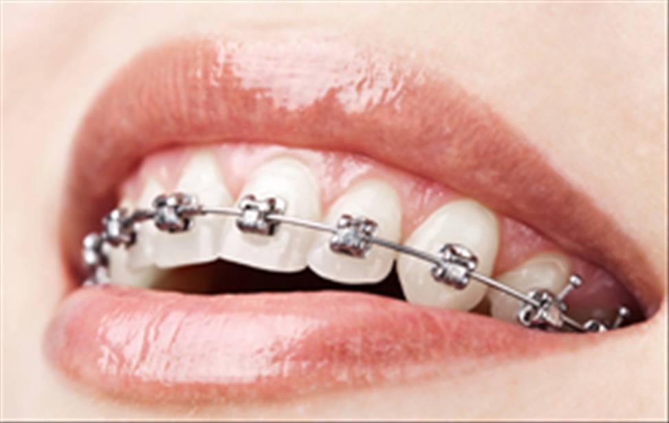 ​ارتودنسی دندان